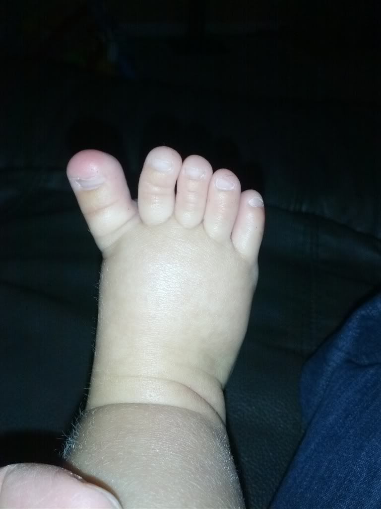 slightly webbed toes